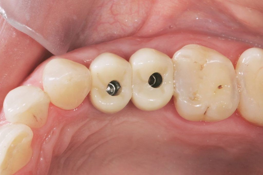 Royaldent-implantatum 18. kerület