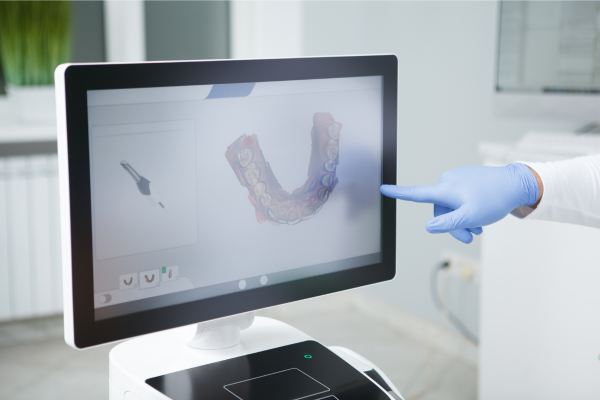 Straumann Sirios Intraorális 3D szkenner