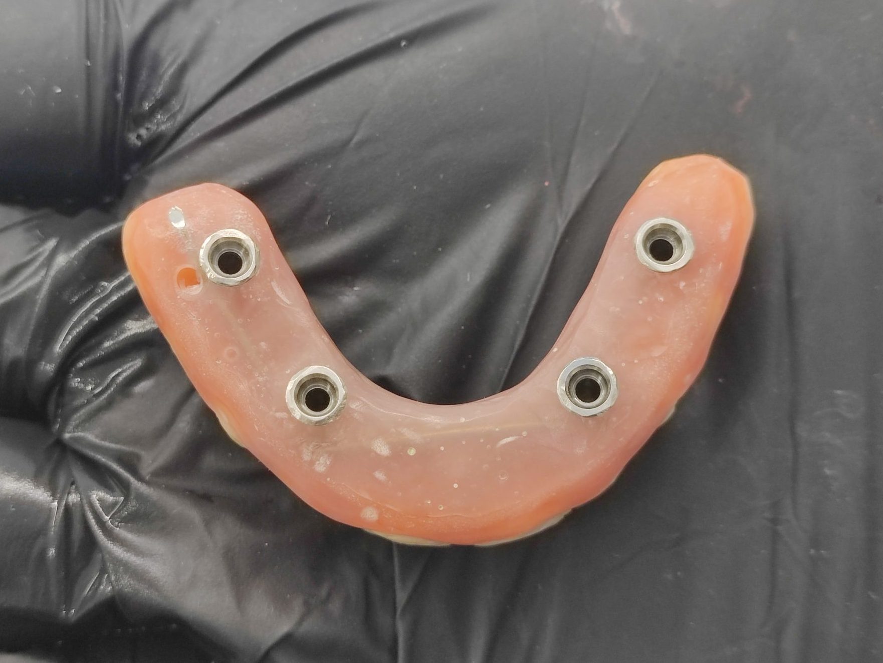 6- Immidiate temporary denture Azonnali fix ideiglenes fogpótlás alulnézetből